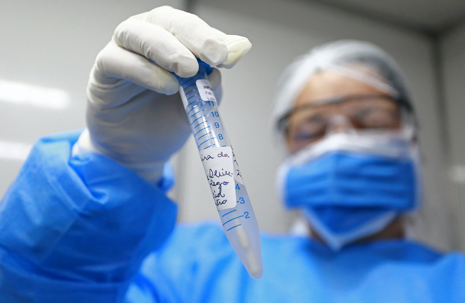 Apenas 2,3% dos testes de Covid-19 na Venezuela são do tipo RT-PCR